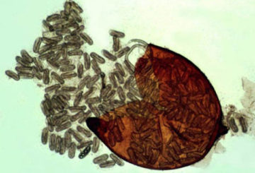 Quiste de nematodo triturado bajo un microscopio