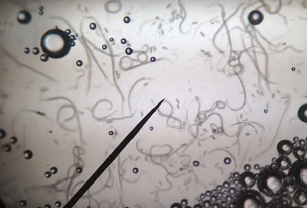 Nematoder under ett mikroskop