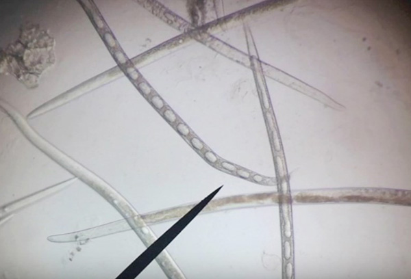 Nematodes under a microscope