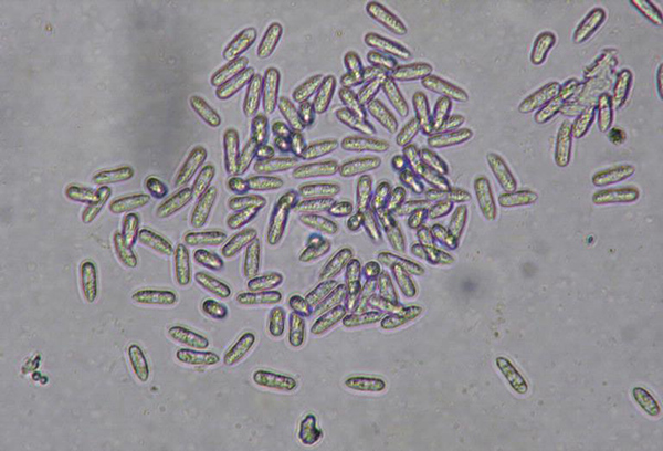 Colletotrichum orbiculare fungus