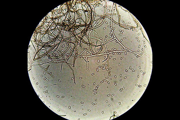 De veroorzaker van anthracnose